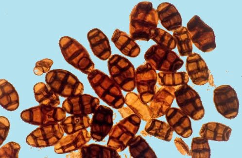 pithomyces chartarum spores facial eczema image credit gribbles veterinary