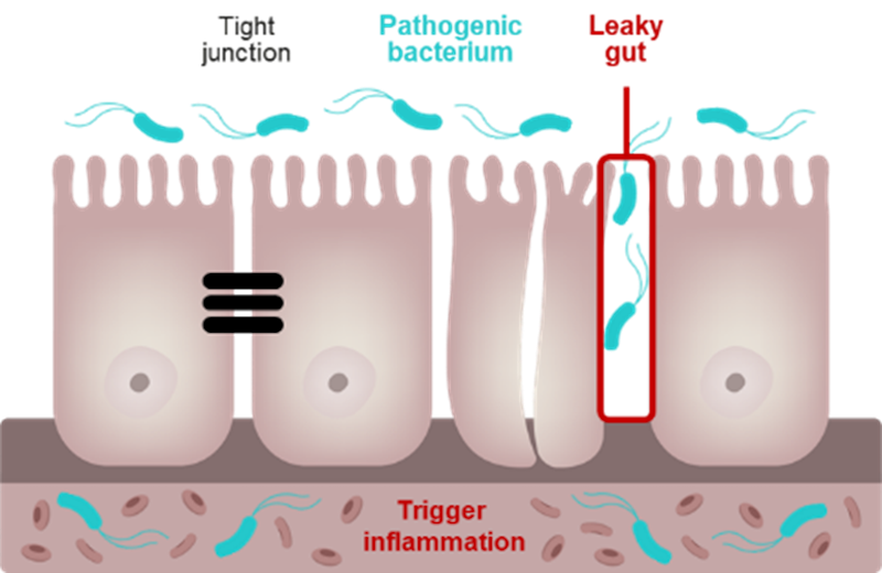 leaky gut